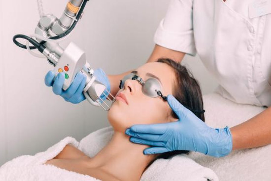 Tratamiento de rejuvenecimiento facial con láser CO2